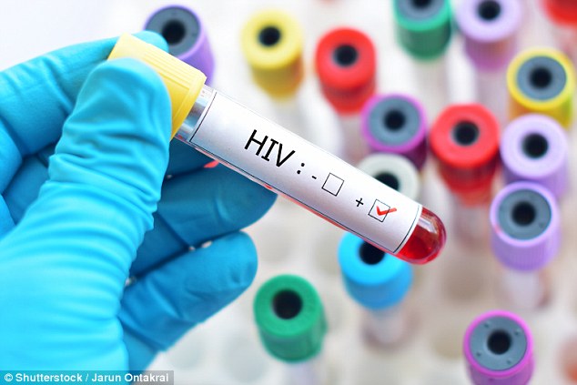 hiv sintomi