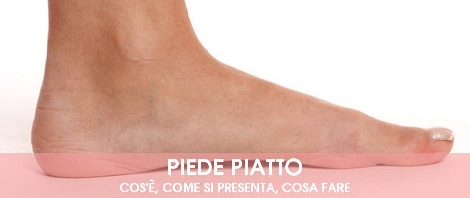 piedi piatti