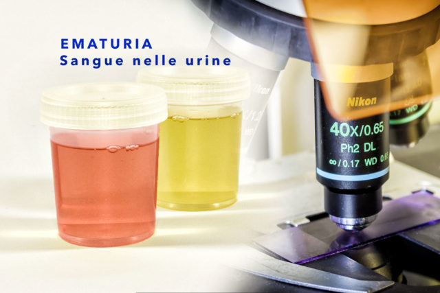 sangue nelle urine