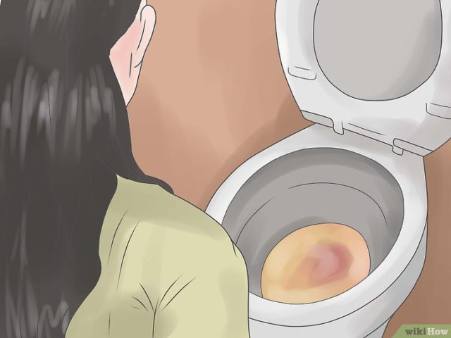 sangue nelle urine