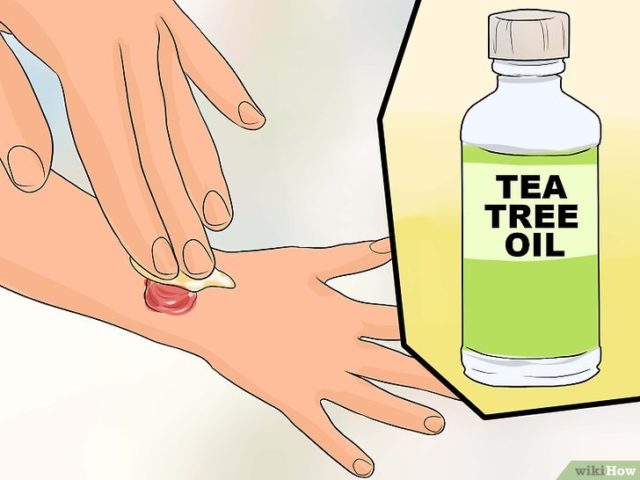 tea tree oil