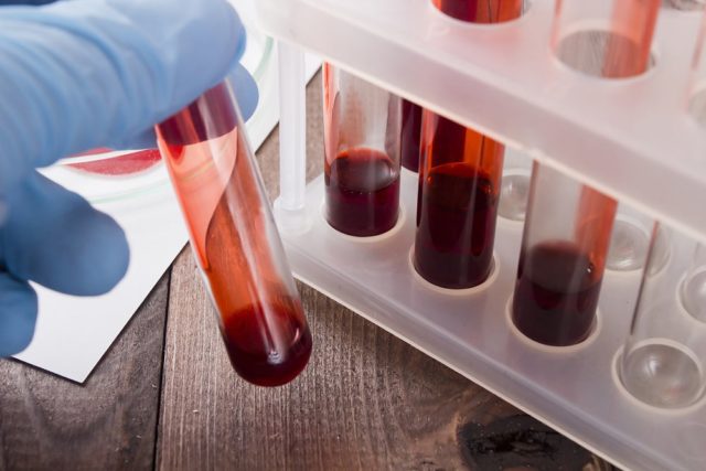 Analisi del sangue