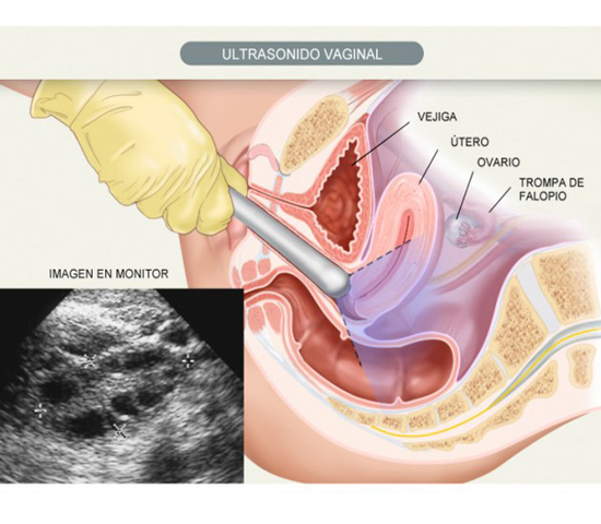 visita ginecologica