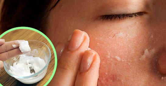 Come preparare la crema per eliminare le rughe e macchie del viso