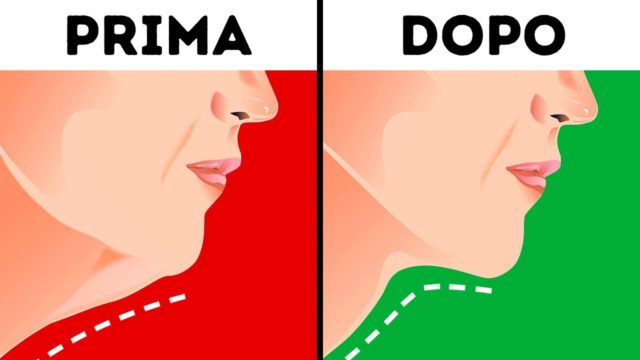 Doppio mento, addio! Ecco come eliminarlo in 5 semplici mosse