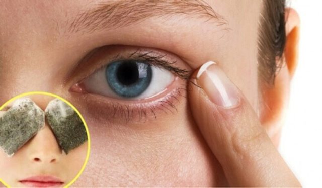 Come eliminare le occhiaie con il bicarbonato