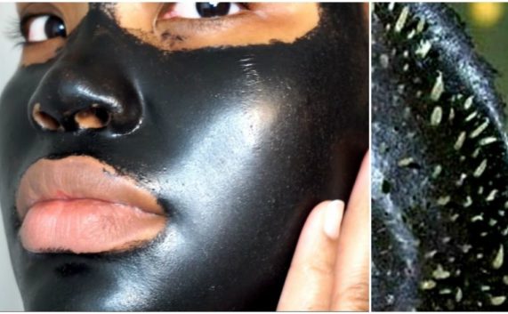 Come eliminare i punti neri dal viso con la black mask