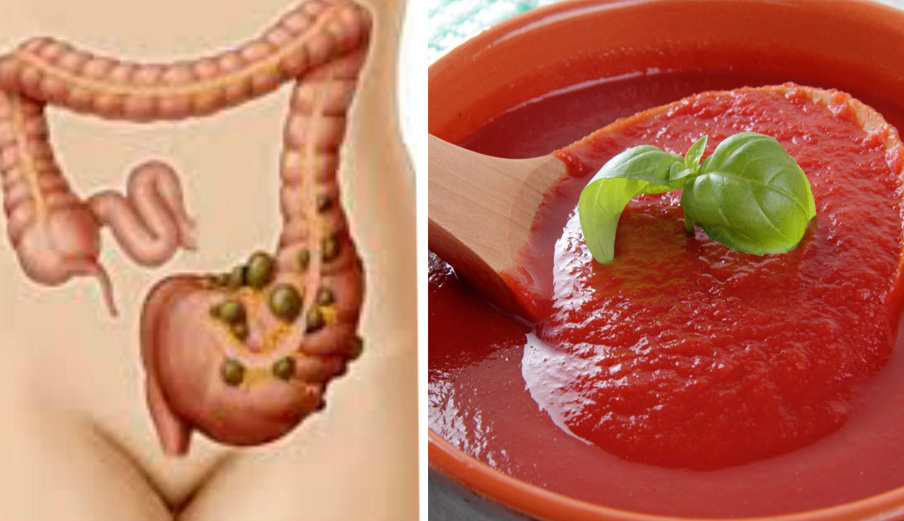 La salsa magica per l'intestino