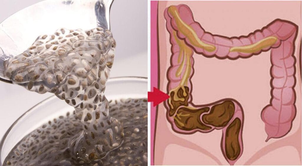 Non bastano le fibre! E’ questo il trucco per risvegliare l’intestino pigro e combattere la stitichezza