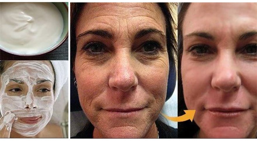 Crema viso effetto botox