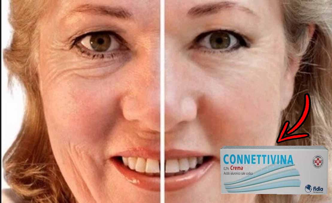 Connettivina: la crema più usata dai chirurghi