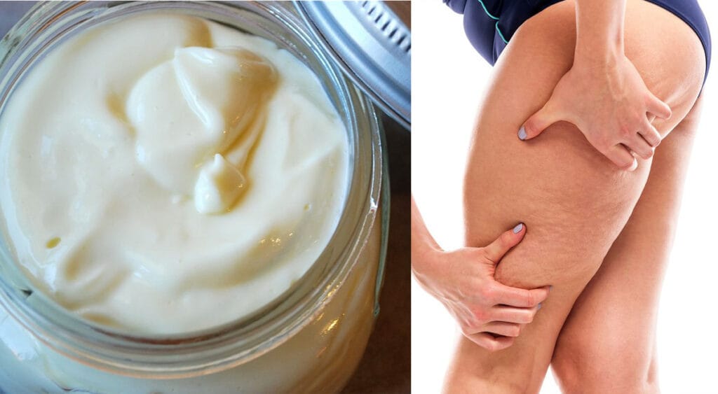 Le 5 migliori creme anticellulite per eliminare il grasso dalle gambe