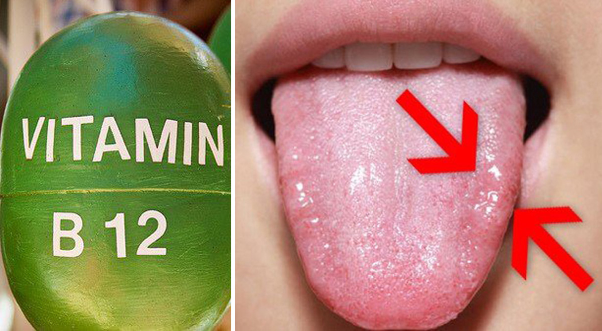 Vitamina B12, carenza e alimenti