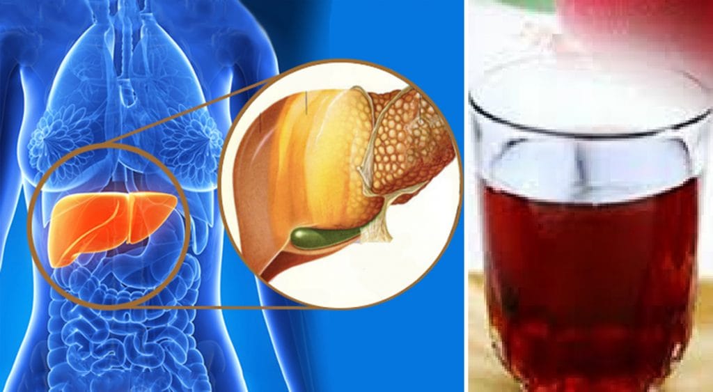 Aceto di melograno, riduce l’accumulo di grasso dal fegato e dal corpo