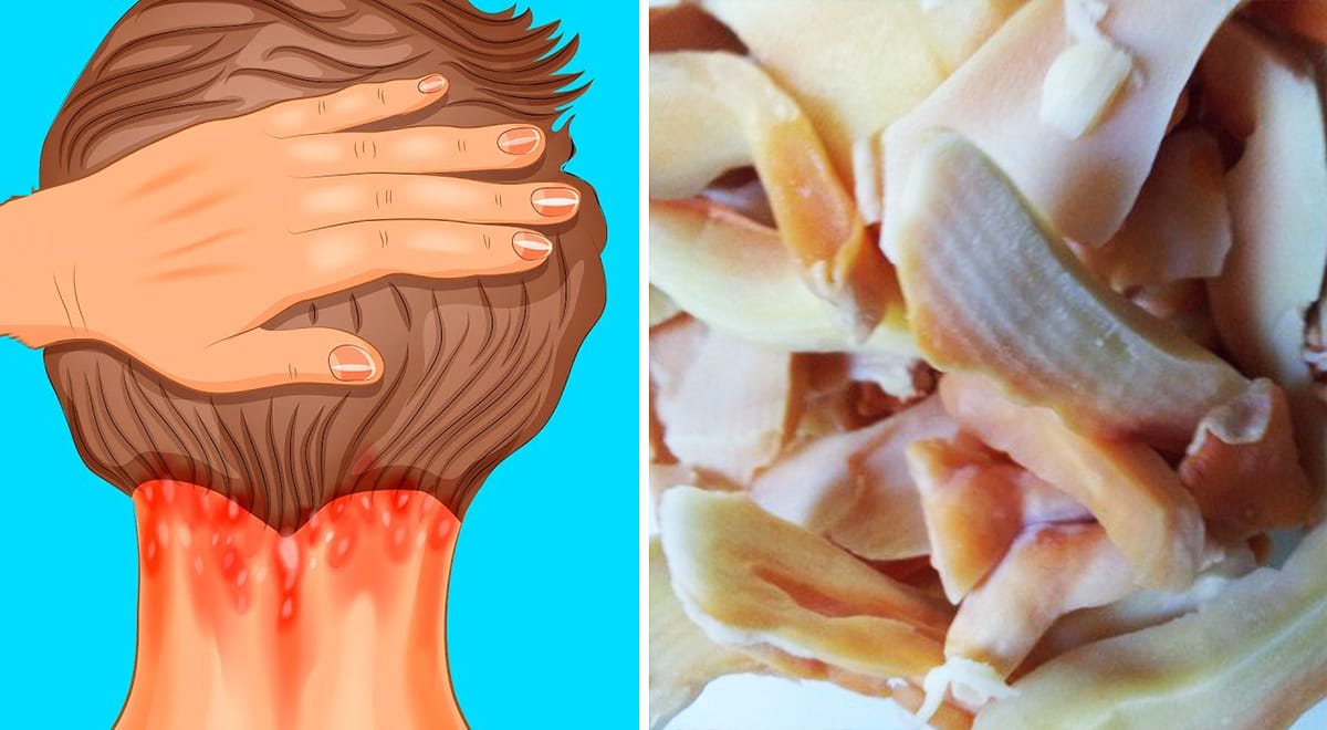 Vitamina D, i 3 cibi più ricchi in assoluto