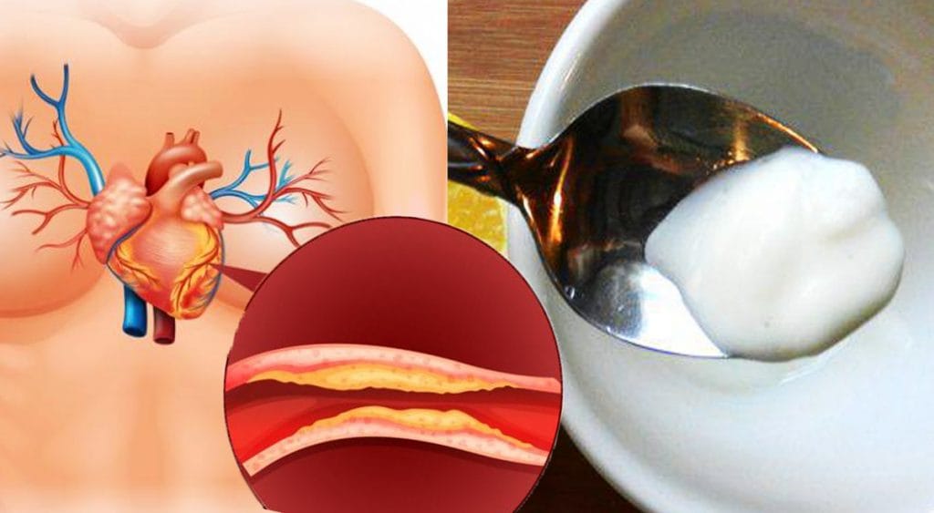 Come abbassare il colesterolo alto? 5 cibi che ti aiuteranno a farlo se li prendi così!