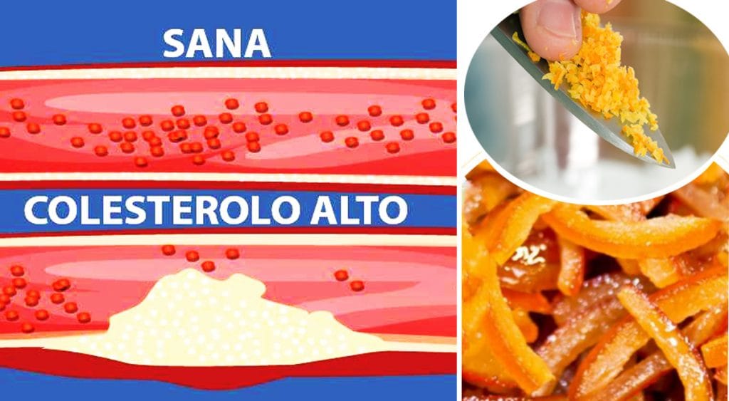 Abbassa il colesterolo e la glicemia alta: il super cibo antinfiammatorio che rafforza anche le difese immunitarie