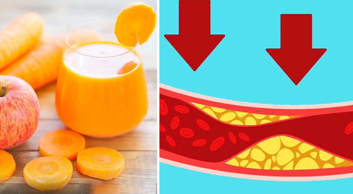 Succo di mela, carote e zenzero per pulire le arterie dal colesterolo