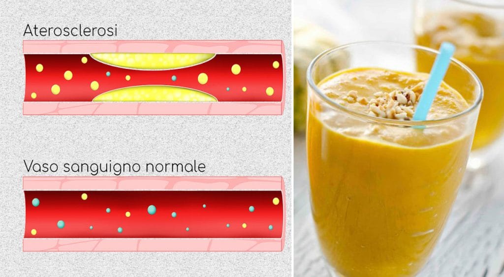 Glicemia e colesterolo alti? Se presa così la zucca può aiutare ad abbassarli!