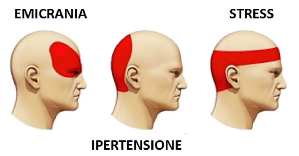 mal di testa