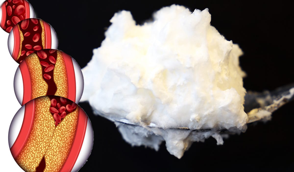 Il superfood che regola il colesterolo, è senza zuccheri e grassi!