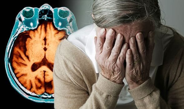 Alzheimer