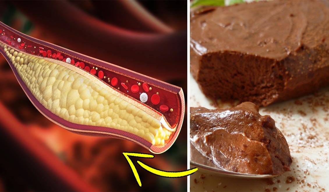 40 grammi al giorno, il superfood che abbassa colesterolo e glicemia