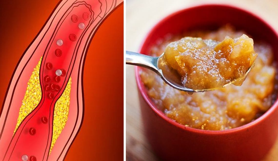 Il super alimento che abbassa colesterolo e glicemia ed è un eccellente diuretico