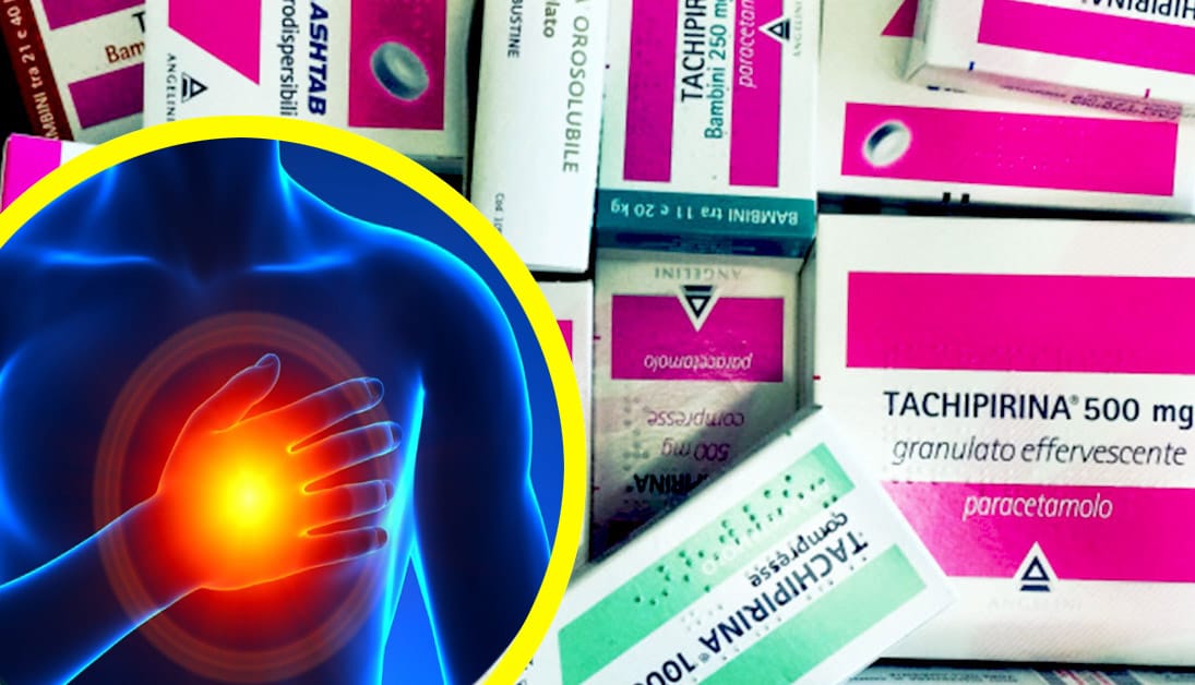Gli esperti avvertono degli effetti collaterali del paracetamolo sul cuore