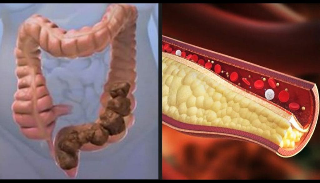 I 3 migliori yogurt per rafforzare la flora intestinale e regolare il colesterolo e la glicemia