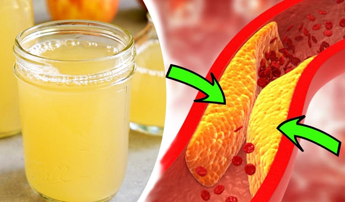 La bevanda d'ora che abbassa i livelli di zucchero nel sangue per mesi