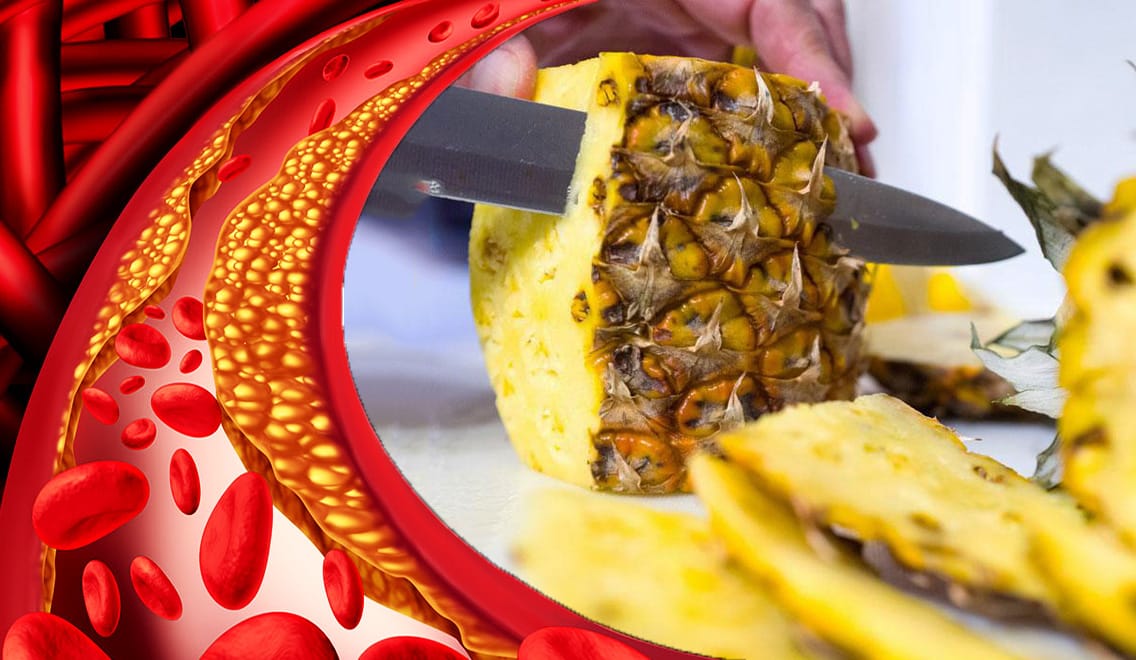 Non buttare le bucce dell'ananas! Se usate così abbassano il colesterolo