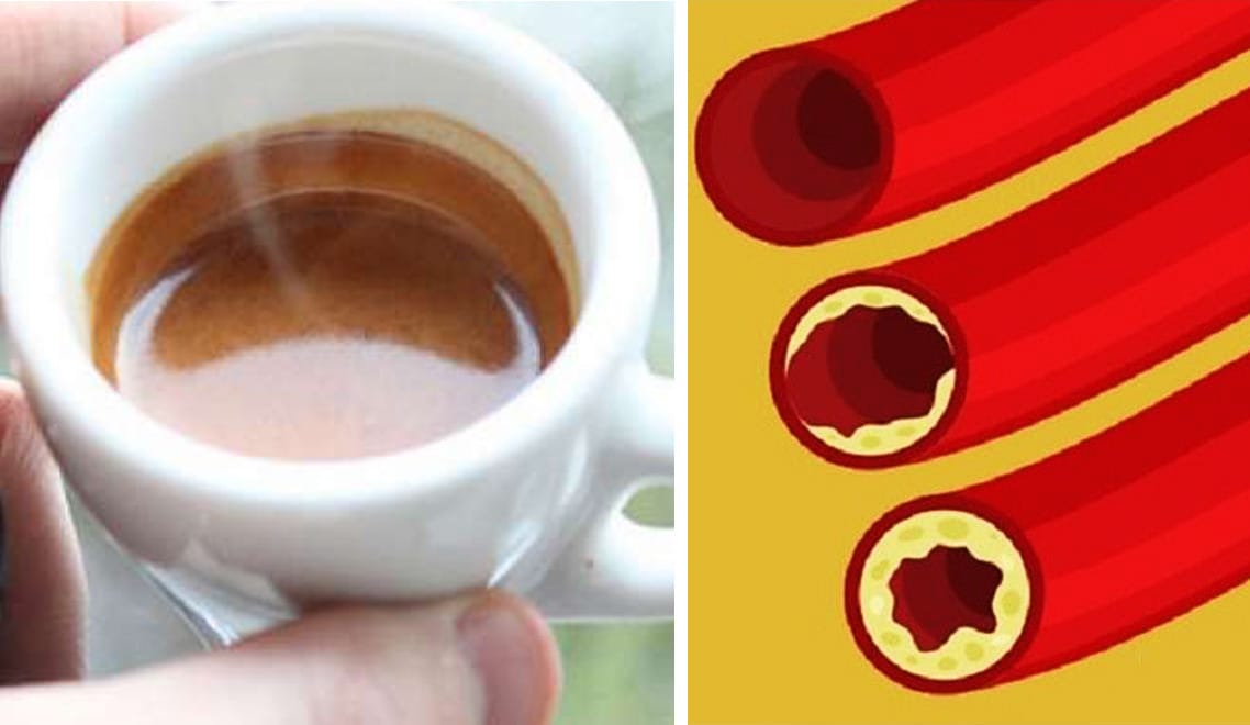 Questo è ciò che succede al colesterolo se bevi 3-4 tazzine d caffè al fiorno