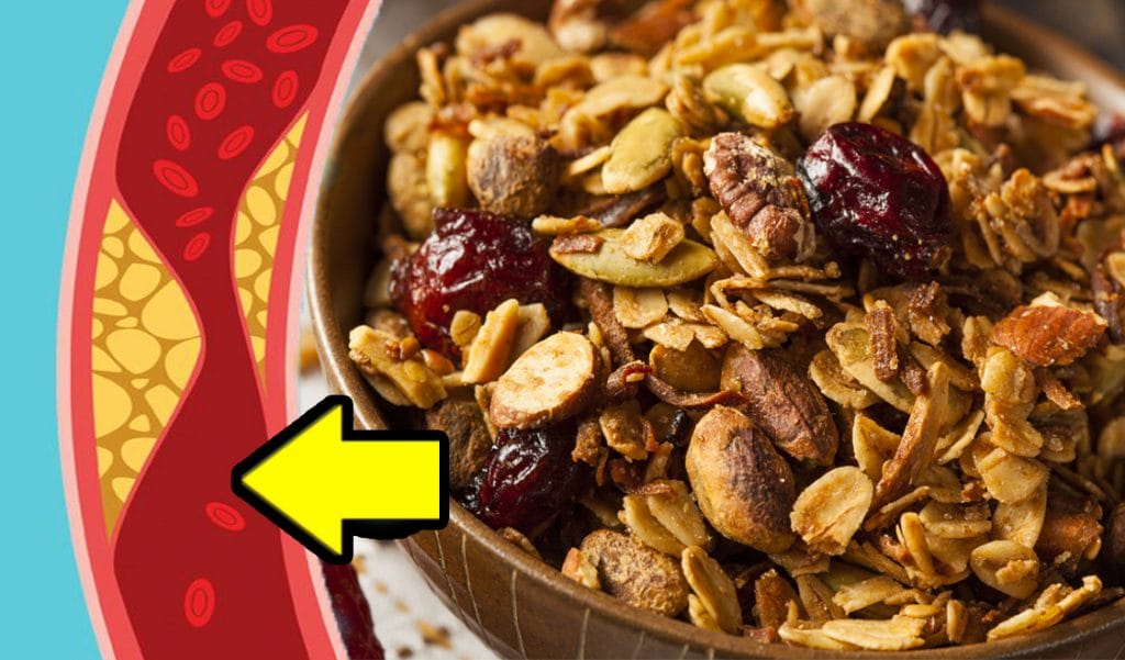 Questo è ciò che accade al colesterolo e glicemia se mangi 30 grammi di granola a colazione