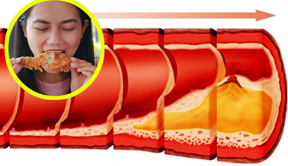 Per abbassare il colesterolo questo è l'orario in cui dovresti mangiare