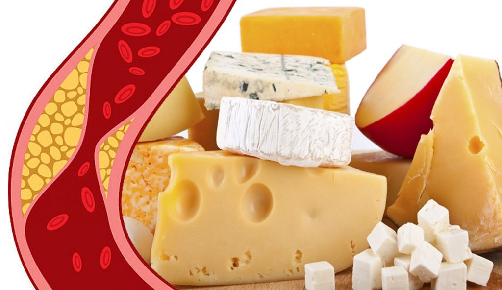 Gli esperti raccomandano: “E’ questa la quantità di formaggio che puoi mangiare senza alzare il colesterolo!”