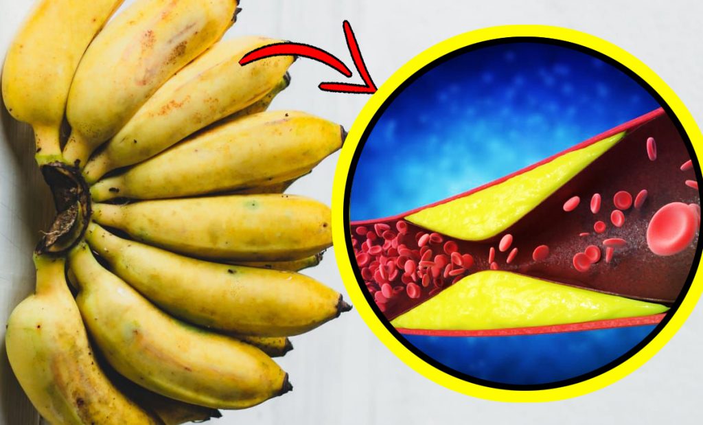 Questo è ciò che succede al colesterolo e glicemia se mangi 1 banana al giorno (lo dice questo studio)