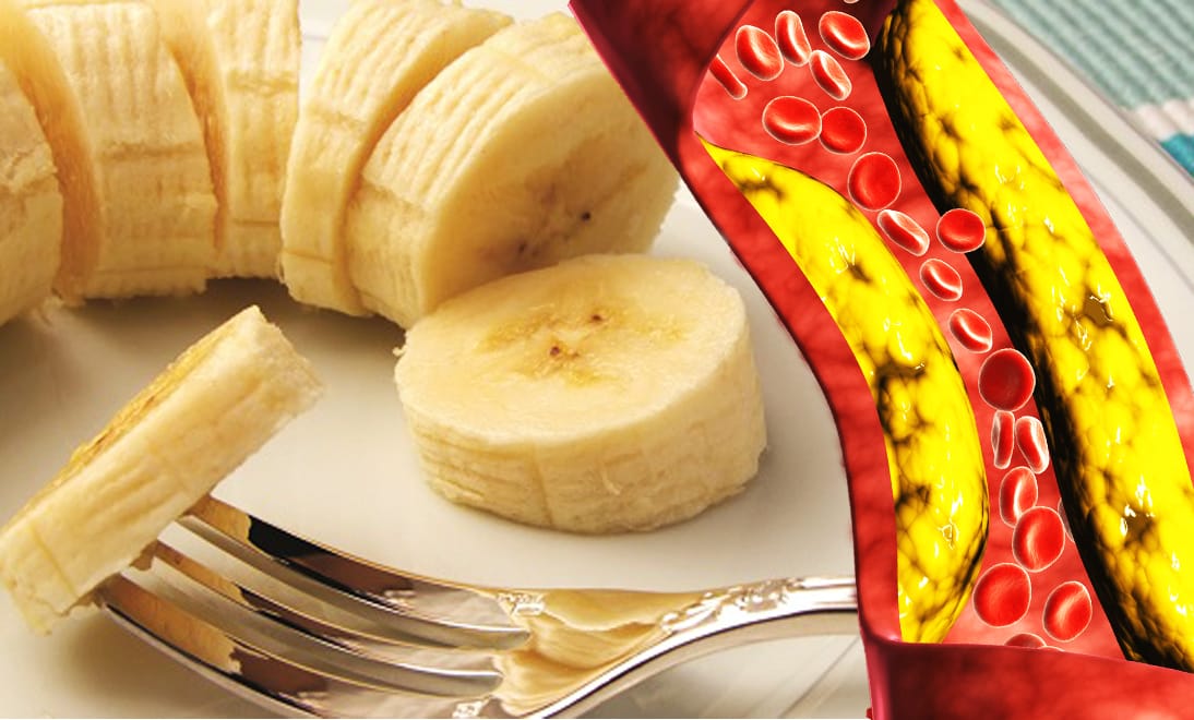 Se la mangi così la banana abbassa colesterolo e glicemia