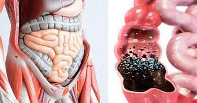 Depurare il colon