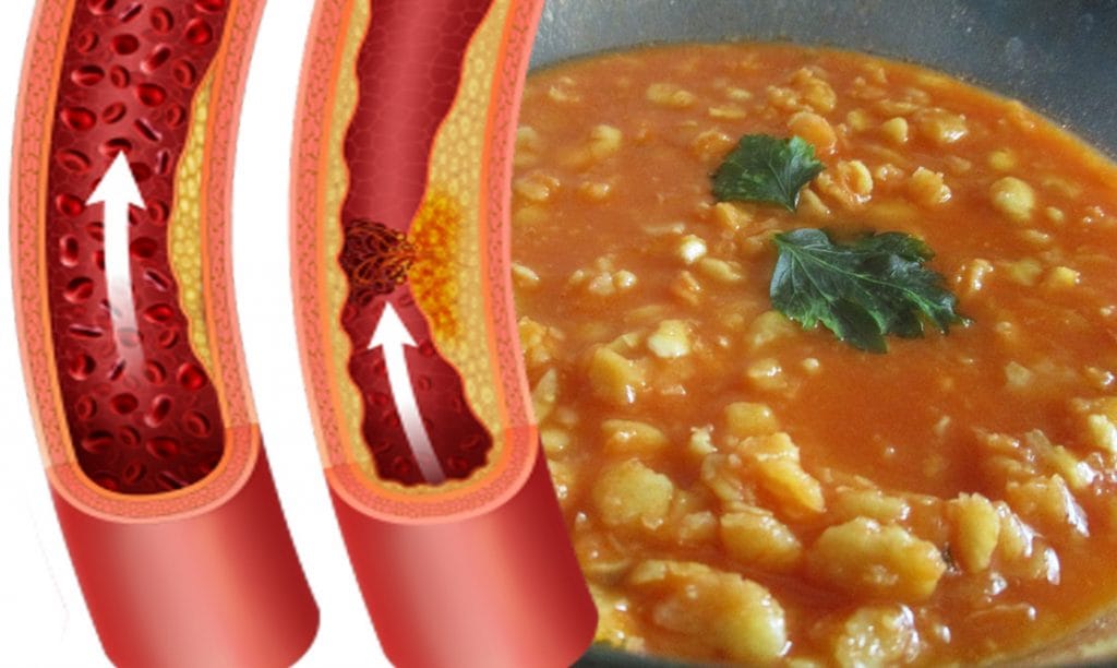 1 porzione a settimana! Il legume proteico che abbassa il colesterolo e frena la fame (non sono i fagioli)