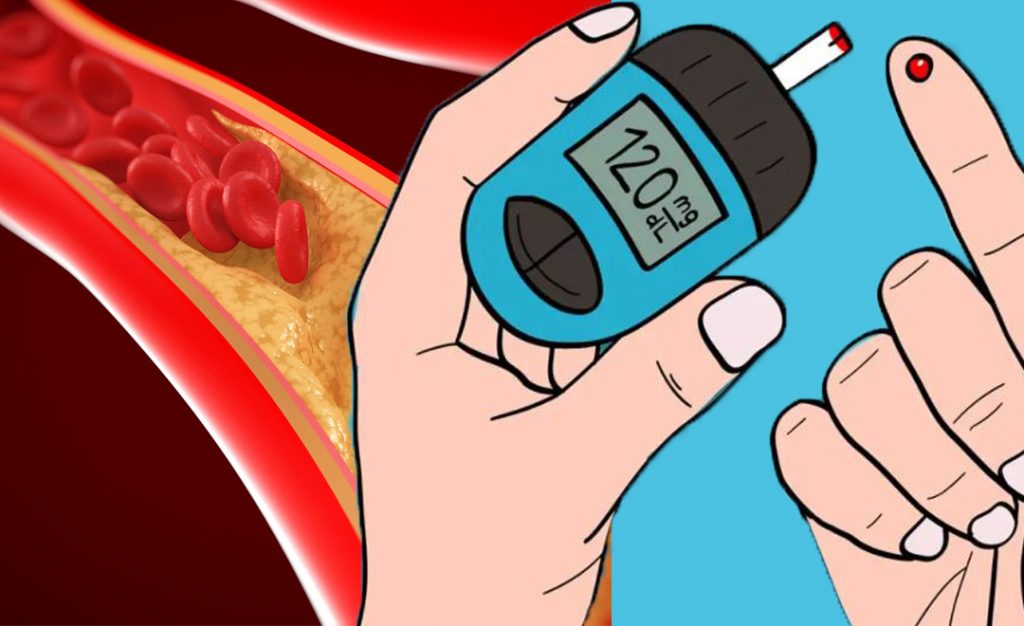 Glicemia alta! Questa cattiva abitudine è la causa numero uno del diabete (fino al 40%)