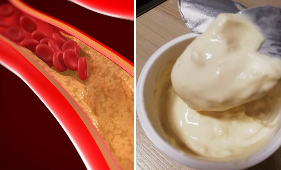 E' simile allo yogurt ma con più proteine, abbassa la glicemia e rafforza le ossa