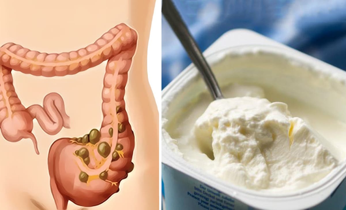 Il migliore yogurt per rafforzare l'intestino e ridurre il rischio di diabete