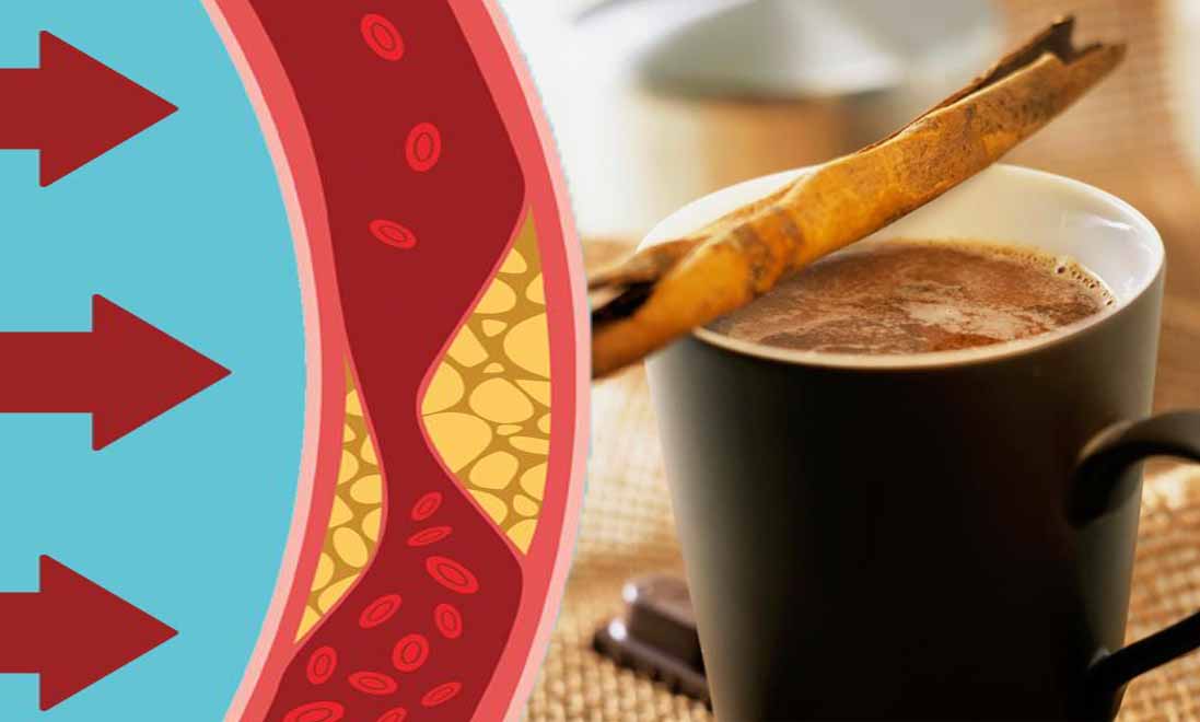 Cosa succede al colesterolo e glicemia se bevi un caffè alla cannella al mattino!