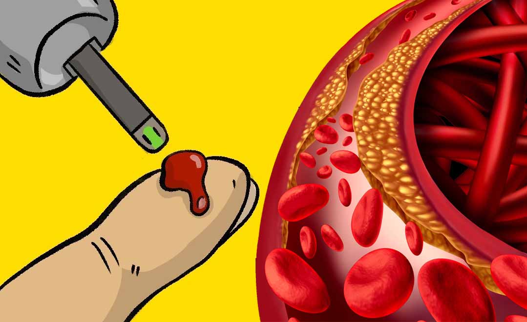 Glicemia alta? La colpa è questa cattiva abitudine che tutti abbiamo!