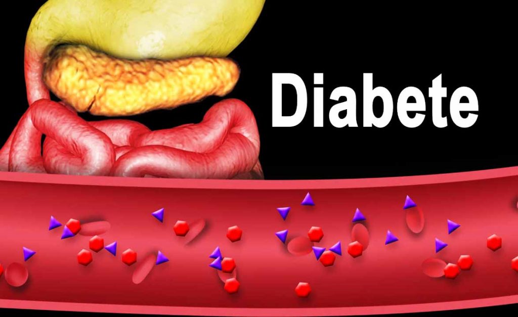 Glicemia alta, il frutto di maggio perfetto per chi soffre di diabete (lo abbassa del 19%). E’ consigliato mangiarne 2 porzioni!