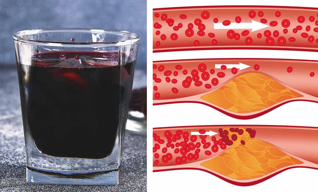 L'antiossidante perfetto per chi soffre di diabete e colesterolo alto!
