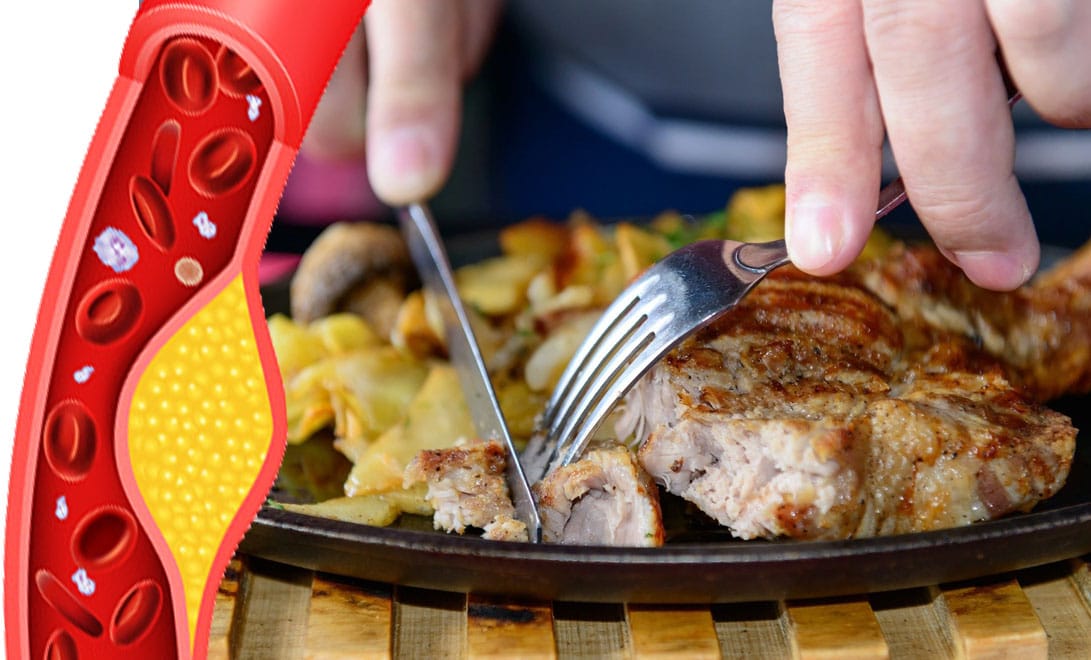 Colesterolo alto? 6 super cibi ricchi di proteine che puoi mangiare al posto della carne