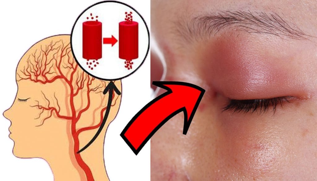 Mangi troppo sale? I 10 segnali che indicano un alto livello di sodio nel corpo