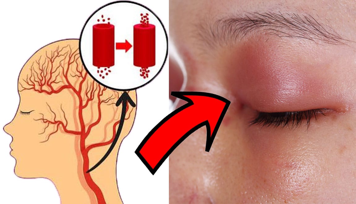 10 sintomi che indicano un eccesso di sale nel corpo